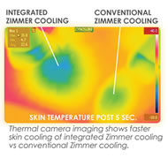 Integrated Zimmer Laser Cooling thermal image